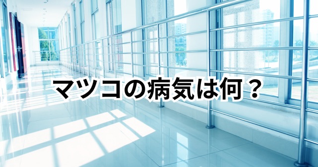 マツコの首の病気は何？脊髄圧迫とはどんな症状かをわかりやすく解説